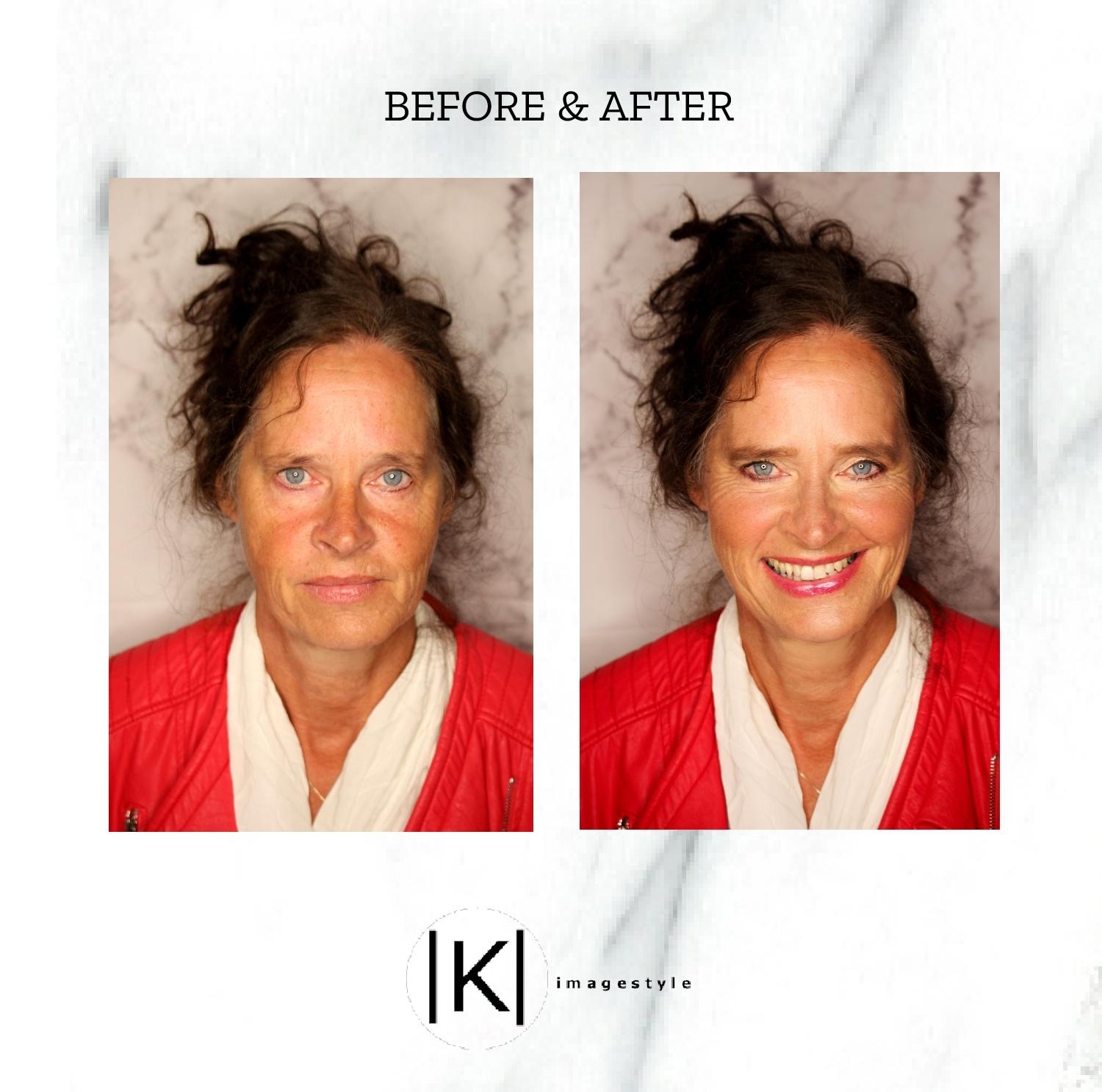 before en after visagie